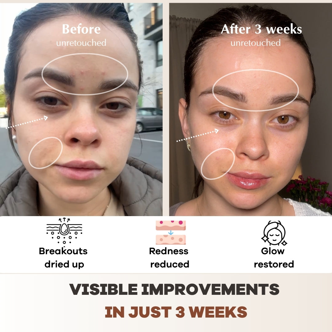 Me Time Ritual Wireless LED Mask PRO