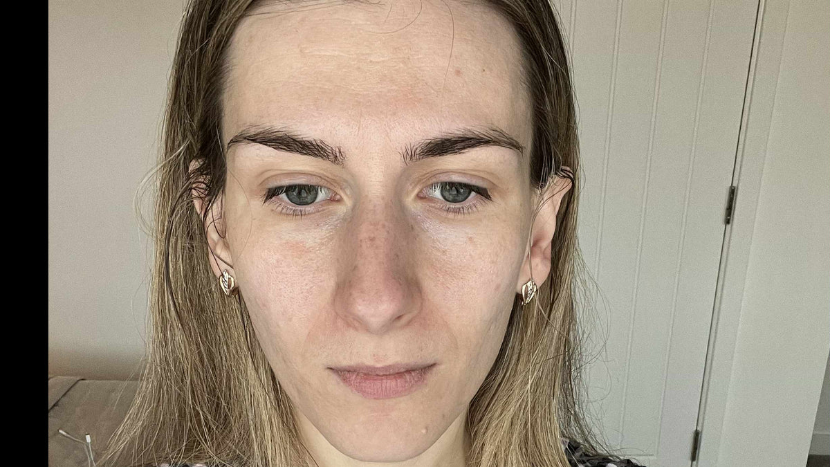 After 2 weeks Woman wearing a black and white checkered blouse indoors.